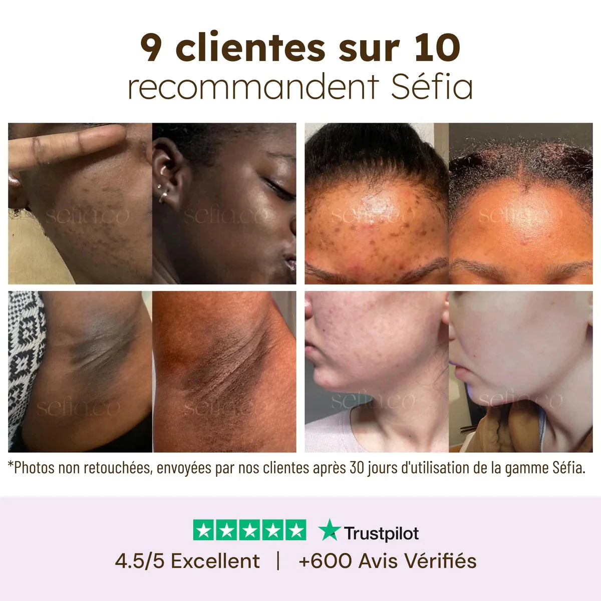 Cotons Anti-Imperfections - Image 3