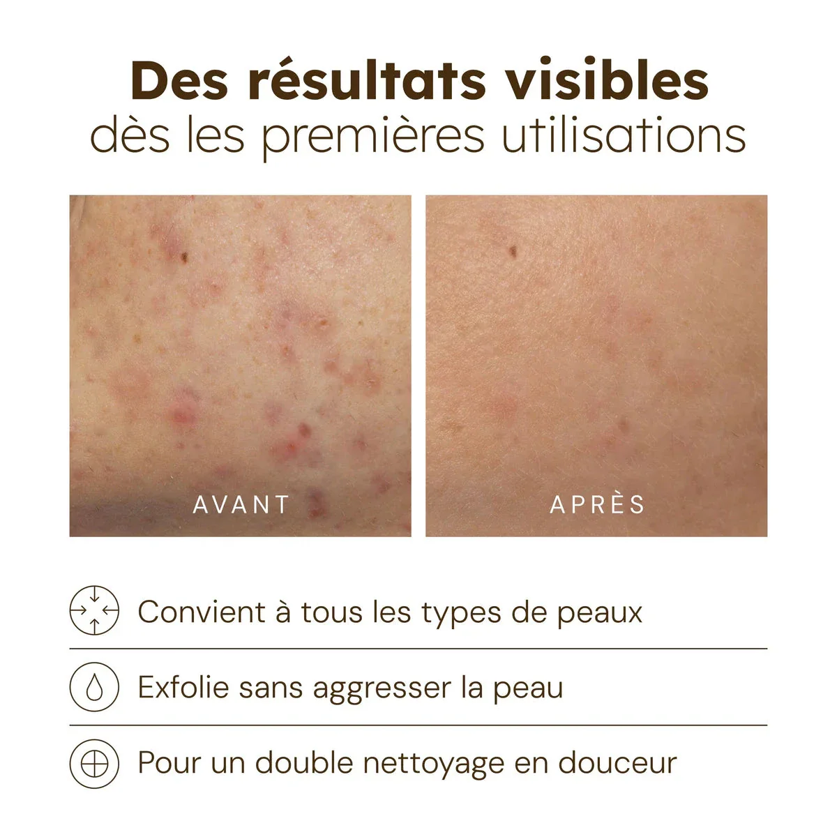 Nettoyant Éclat au Curcuma - Image 8