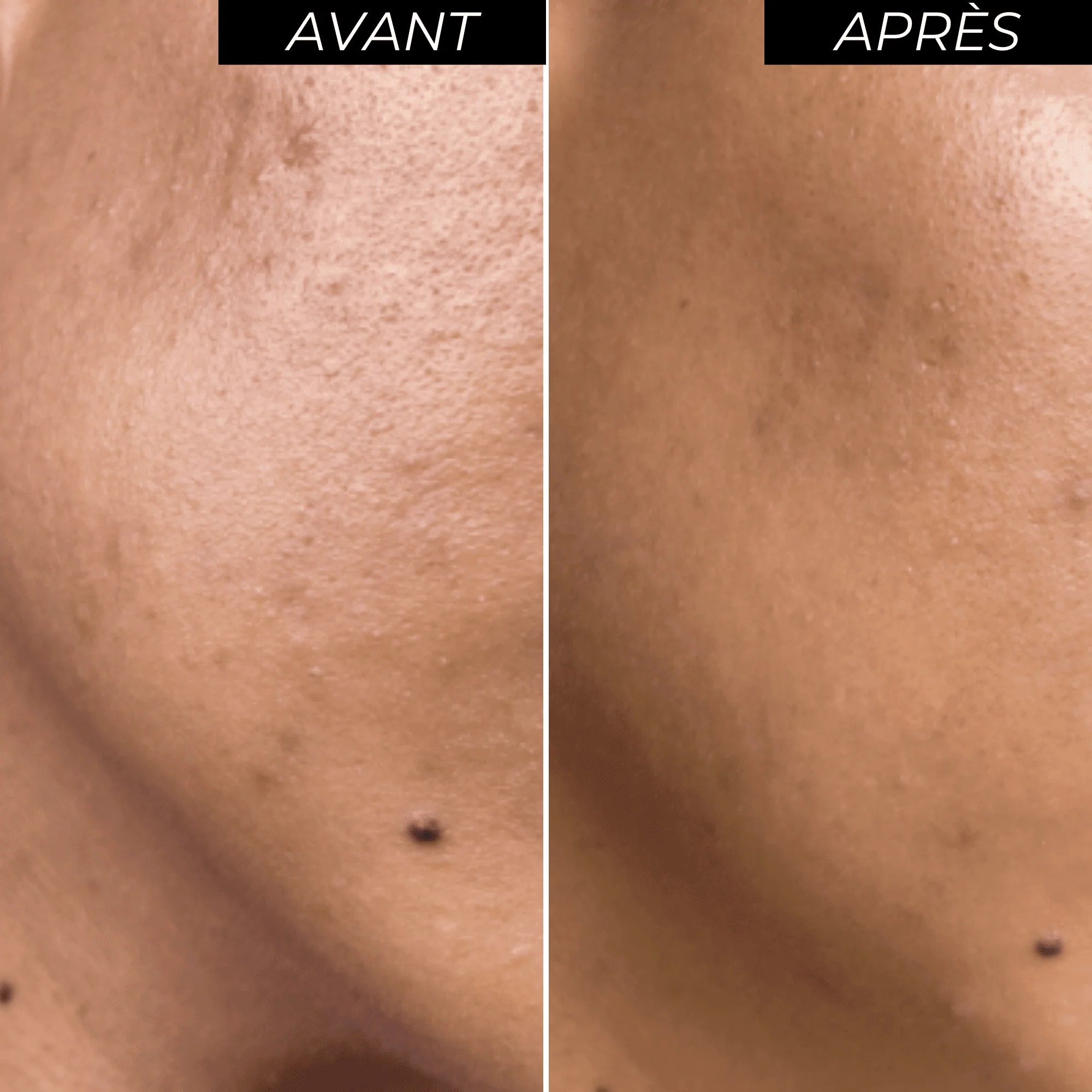 Peeling visage ENOLISS 15 - Image 5