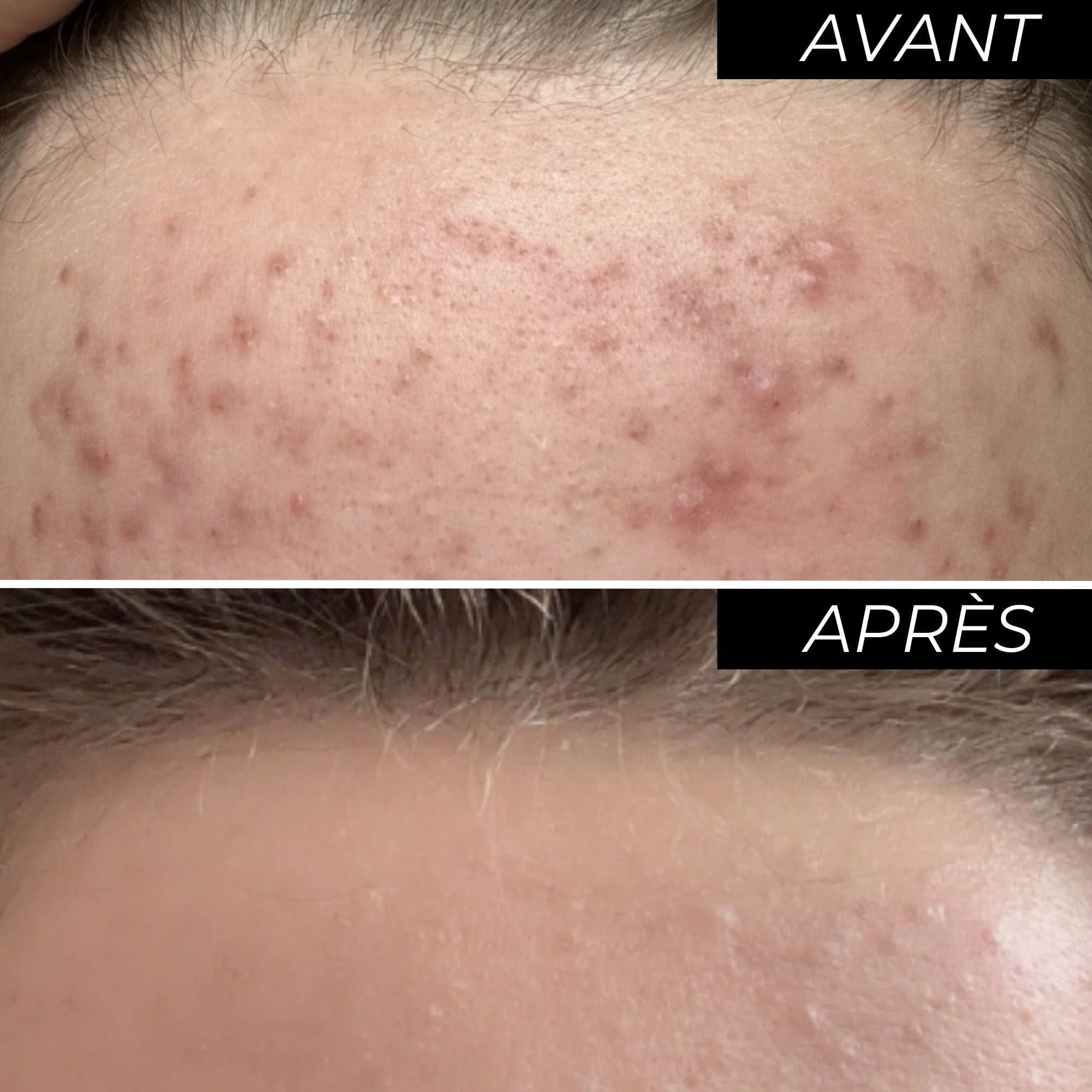 Peeling visage ENOLISS 15 - Image 6